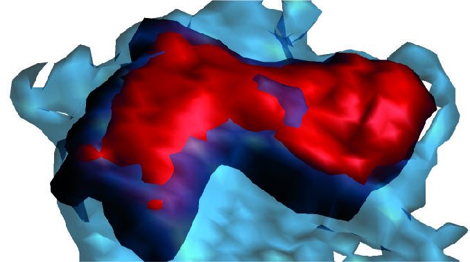 Scientists-discover-a-cell-behavior-pattern-that-predicts-cardiovascular-disease.jpg