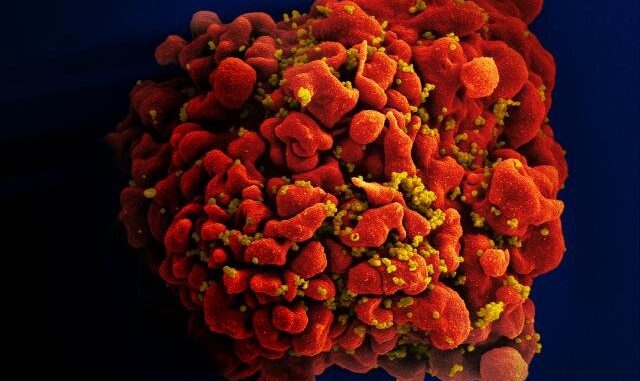 Researchers-document-third-known-case-of-HIV-remission-involving-stem-cell-transplant.jpg