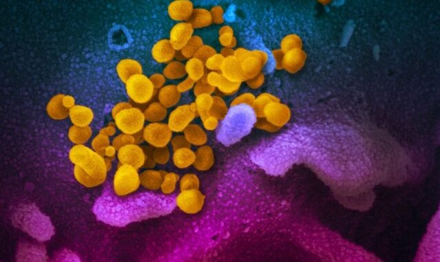 Longest-known-COVID-19-infection—505-days—described-by-UK-researchers.jpg