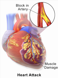 Mayo-Clinic-Minute-Why-womens-risk-of-heart-disease-increased-during-the-pandemic.jpg