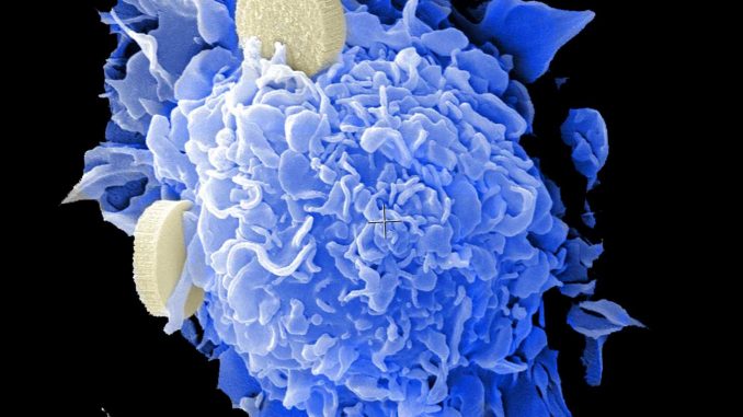 Scientists-identify-potential-new-soldier-for-cancer-immunotherapy.jpg