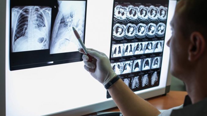 Researchers-propose-DLPE-method-to-extract-interpretable-and-predictive-subvisual-features-from-CT-scans-of-COVID-19-inpatients-and-survivors.jpg
