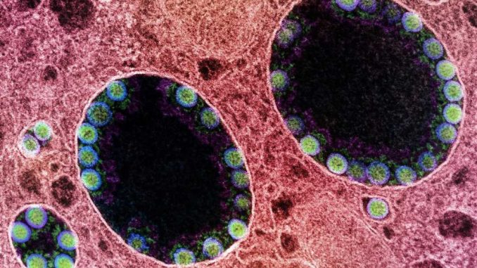 SARS-CoV-2-Omicron-subvariants-are-increasingly-escaping-immunity.jpg