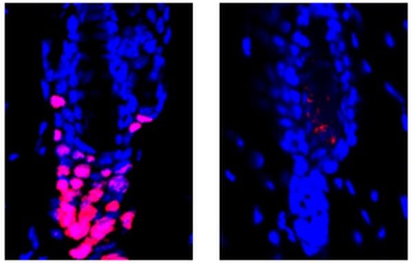 Hair-raising-research-Scientists-find-surprising-link-between-immune-system-hair-growth.jpg