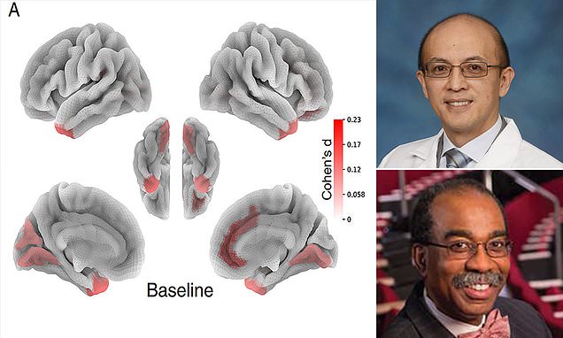 Kids-who-get-less-than-nine-hours-of-sleep-develop-less-brain-matter.jpg