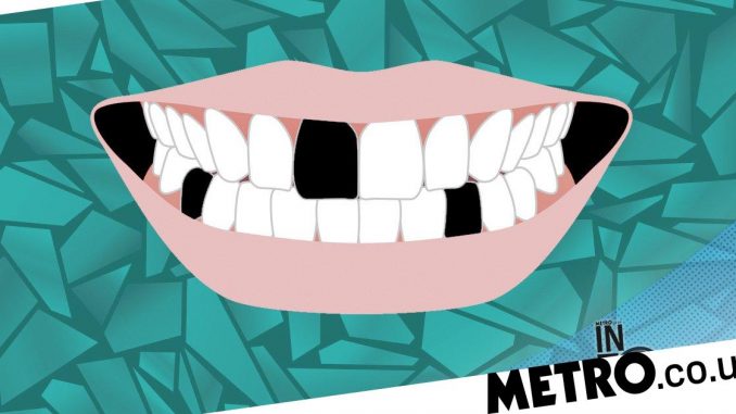 ‘I-pulled-out-five-of-my-teeth-The-rise-of-DIY-dentistry.jpg