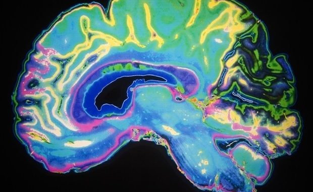 Consuming-more-omega-3s-associated-with-better-brain-health-and-cognition-in-middle-age.jpg