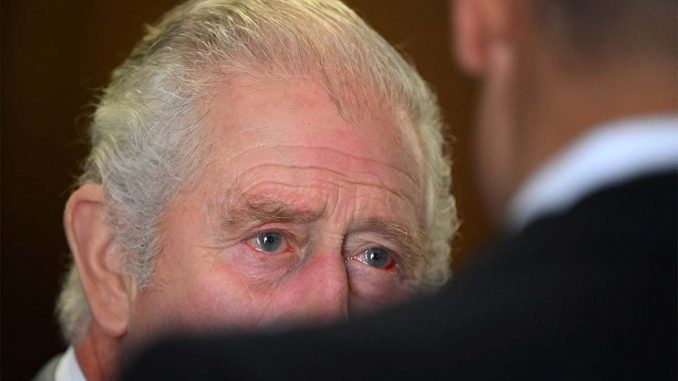 King-Charles-spotted-with-bloodshot-eyes.jpg