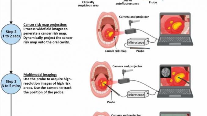 An-accurate-integrated-imaging-and-projection-system-for-oral-cancer-diagnosis.jpg