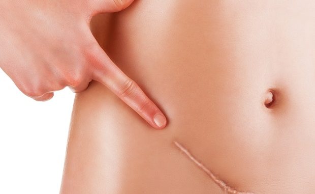 Loyalty-card-data-on-over-the-counter-drug-purchases-could-help-spot-ovarian-cancer-cases-earlier.jpg