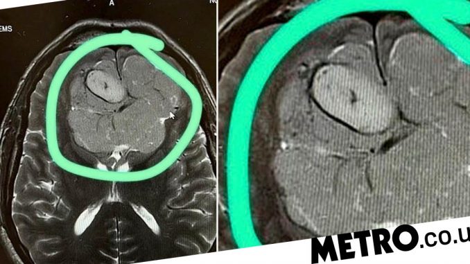 Man-who-thought-he-was-going-for-a-routine-eye-test-diagnosed-with-brain-tumour.jpg