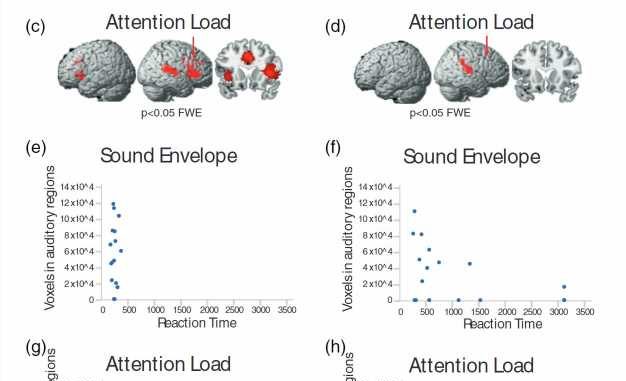 Predisposition-to-accidental-awareness-under-anesthesia-identified-by-neuroscientists.jpg