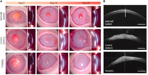 Team-develops-extracellular-matrix-based-sticky-sealants-for-corneal-tissue-reconstruction.jpg