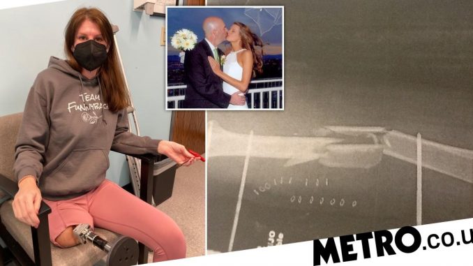 Woman-who-lost-her-husband-and-leg-in-horror-crash-becomes-disability-advocate.jpg