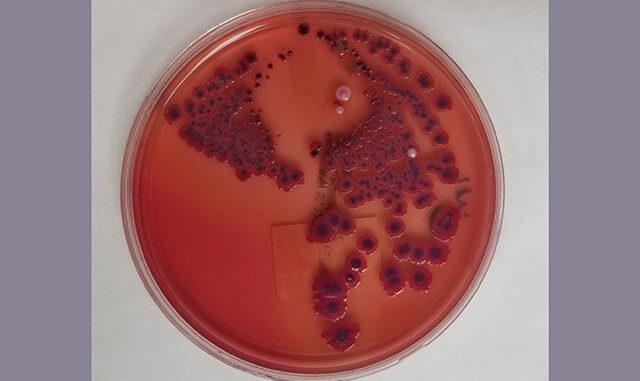 Genomic-methods-aid-study-of-Seattle-2017-2022-Shigella-outbreak.jpg