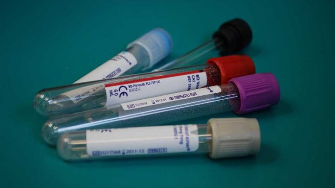 How-do-blood-tests-work-Medical-laboratory-scientists-explain-the-pathway-from-blood-draw-to-diagnosis-and-treatment.jpg