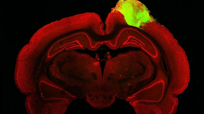 Human-brain-organoids-respond-to-visual-stimuli-when-transplanted-into-adult-rats.jpg