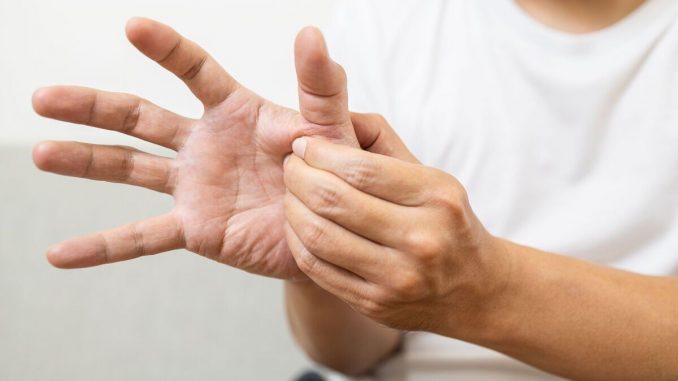Hypothyroidism-patients-often-spot-carotenemia-on-their-palms.jpg