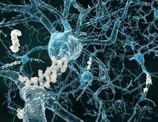 Setting-new-guidelines-for-innovative-services-to-prevent-Alzheimers-disease.jpg