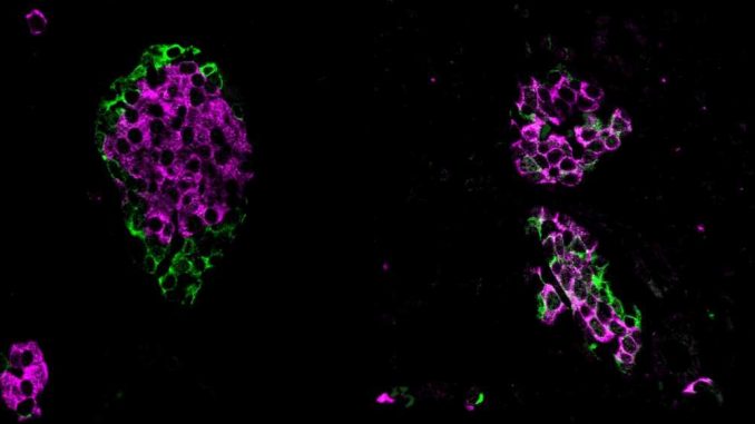Tiny-but-mighty-gene-fragments-are-crucial-for-maintaining-blood-glucose-levels-shows-study.jpg