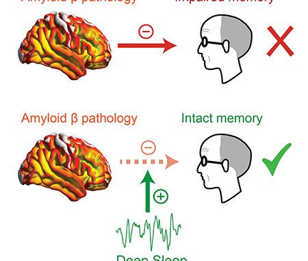Deep-sleep-may-mitigate-Alzheimers-memory-loss-research-shows.jpg