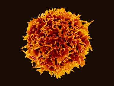 Researchers-uncover-new-details-on-rare-immune-disease.jpg