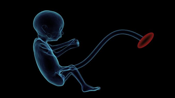 Team-performs-first-of-its-kind-in-utero-procedure-to-fix-deadly-vascular-malformation.jpg