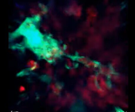 Macrophages-that-rapidly-digest-dying-B-cells-may-point-to-future-autoimmune-disorder-treatments.jpg