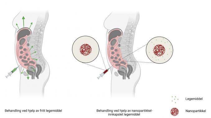 Nanotechnology-can-provide-more-effective-treatment-for-patients-with-peritoneal-cancer.jpg