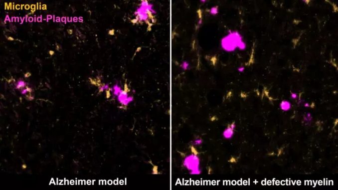 Poorly-insulated-nerve-cells-shown-to-promote-Alzheimers-disease-in-old-age.jpg