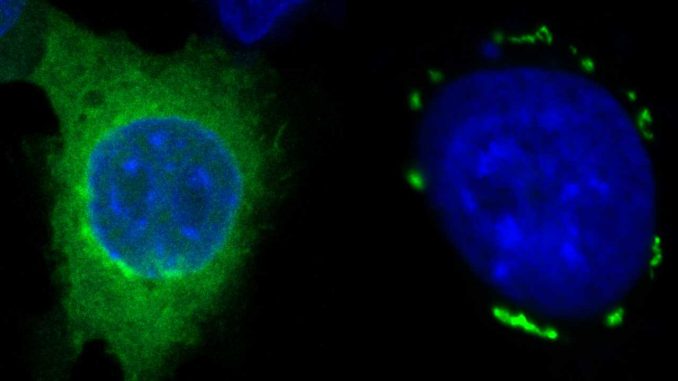 Team-introduces-new-approach-in-cancer-therapy-with-innovative-mechanism-of-action-for-ferroptosis-induction.jpg