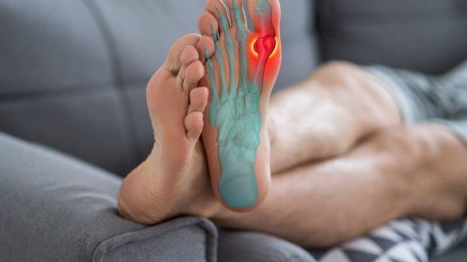 SGLT2i-use-linked-to-reduced-risk-for-flare-in-adults-with-gout-T2D.jpg