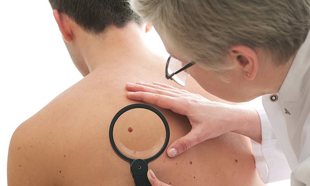 aposI-fear-mole-could-be-cancer-but-I-canapost-get-GP-appointmentapos.jpg