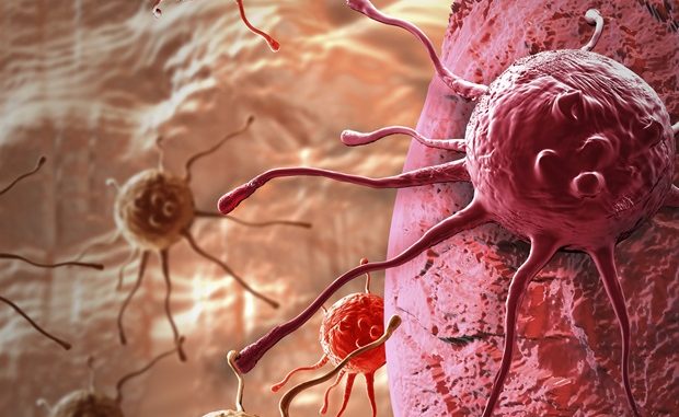 AI-based-predictive-tool-could-help-guide-treatment-of-cancer.jpg