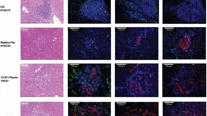 Antibody-shows-promise-for-preventing-organ-rejection-after-transplantation.jpg